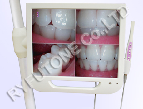 17inch HD Oral Camera 5 Million Pixel Dental 1/4 CCD With WiFi transmission Intraoral Camera with LCD Monitor for Dental Clinic