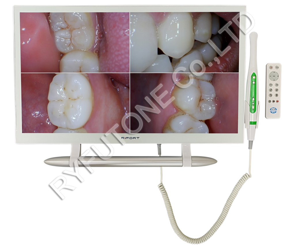 FULL HD 1080P Intraoral Camera System With Oversized Display WIFI Transmission Easy Operate For Oral Health Examination