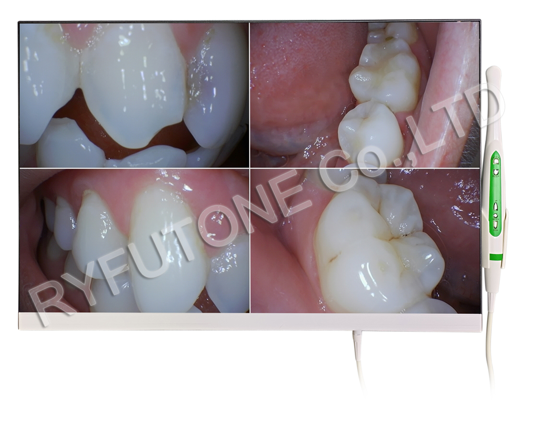 FullHD 1920*1080P 24inch Intraoral Camera System HDMI/VGA Input Oral Camera Dentist Cosmetic Dentistry BEAUTY INSTITUTE